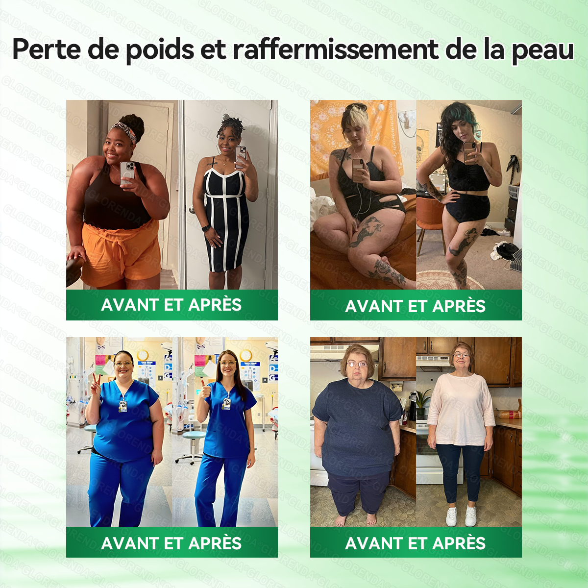 Boutique officielle |  🎄 GLORENDA® 2026 Moringa & Berbérine × NAD+ Patch micro-nano avancé 4-en-1(À utiliser une fois par jour, résultats visibles en 7 jours)✅ Pour l’obésité, le relâchement cutané, l’apnée du sommeil, les problèmes articulaires 🎁