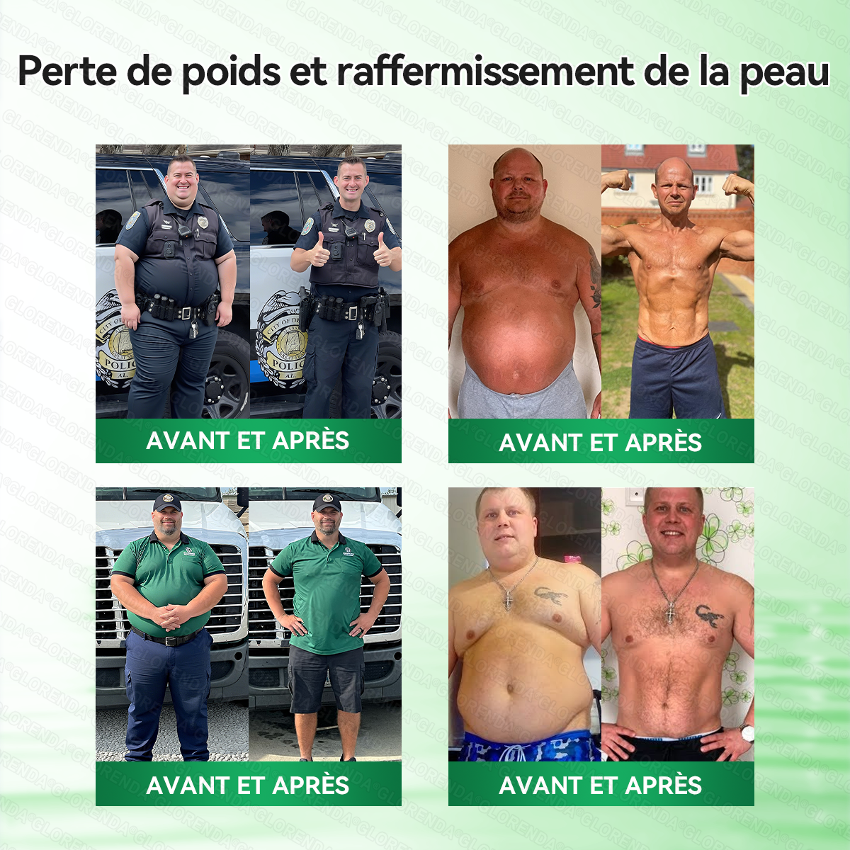 Boutique officielle |  🎄 GLORENDA® 2026 Moringa & Berbérine × NAD+ Patch micro-nano avancé 4-en-1(À utiliser une fois par jour, résultats visibles en 7 jours)✅ Pour l’obésité, le relâchement cutané, l’apnée du sommeil, les problèmes articulaires 🎁